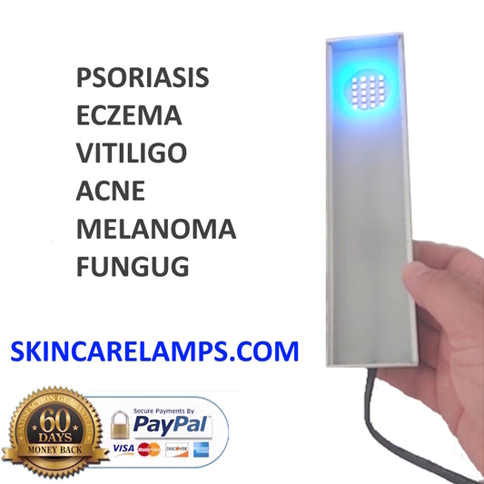 Psoriasis Eczema treatment lamp