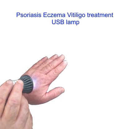 Psoriasis Eczema Vitiligo treatment USB lamp